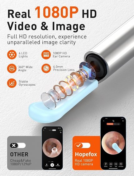 Mit einem smarten Ohrenreiniger kann man sich die Ohren angeblich effektiver als mit Wattestäbchen reinigen.