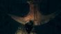 <strong>Pendelfalle</strong> (Dark Souls) - Sens Festung ist ein einziger Spießrutenlauf. Wenn euch die blutrünstigen Echsenkrieger nicht erwischen, dann eben die zahllosen Fallen. Die großen Pendeläxte sind hier besonders hervorzuheben. Diese töten euch zwar nicht sofort, dafür landet ihr allerdings unten in einer Moorgrube voller Kreaturen. 
